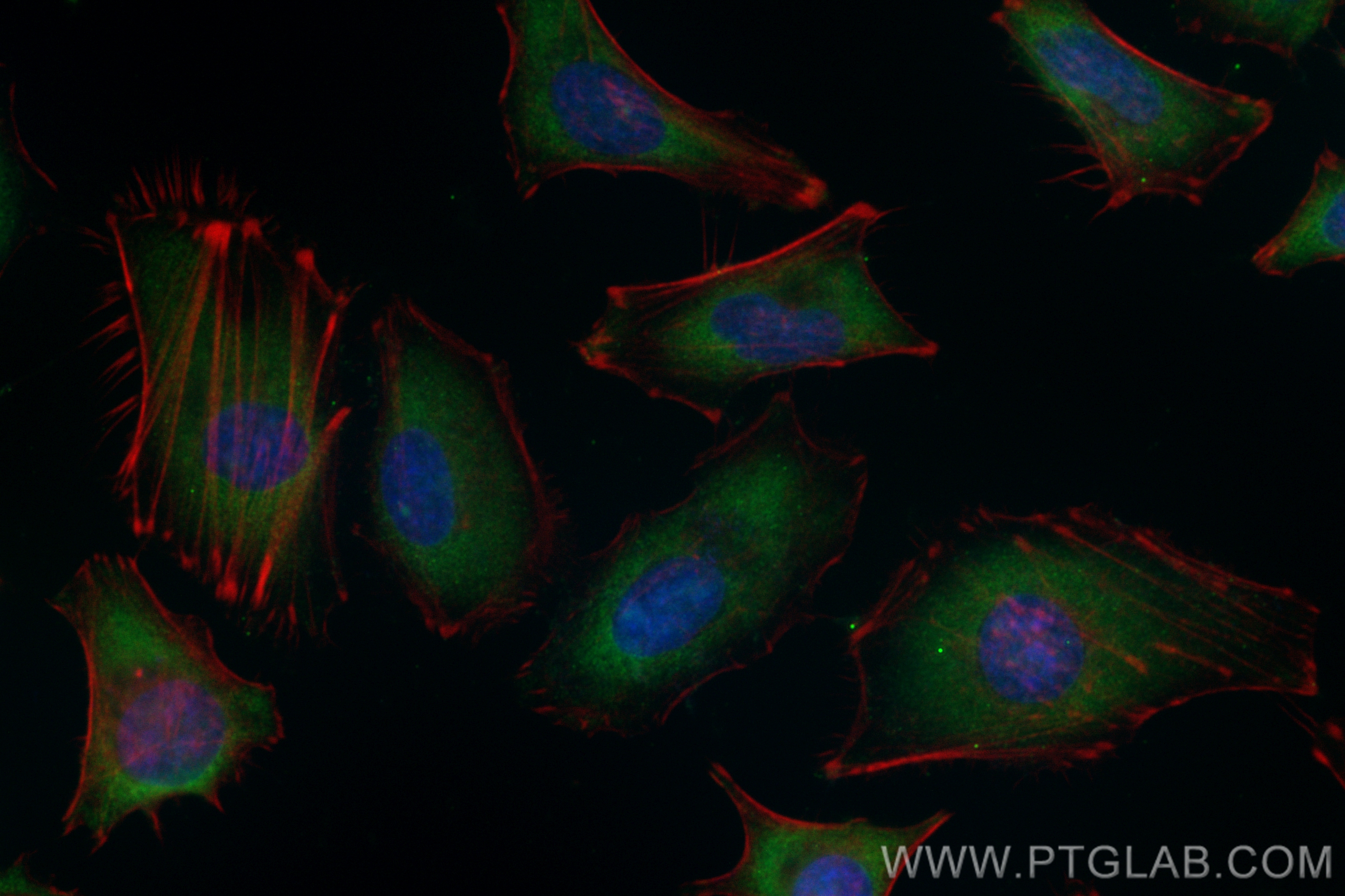 Immunofluorescence (IF) / fluorescent staining of HeLa cells using CoraLite® Plus 488-conjugated HIP1R Monoclonal ant (CL488-68403)