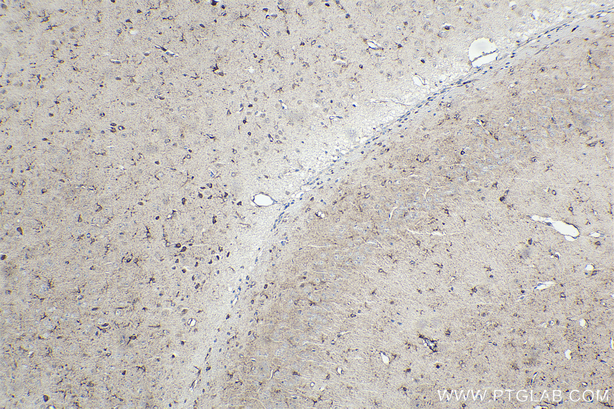 Immunohistochemistry (IHC) staining of mouse brain tissue using HIPK2 Polyclonal antibody (55408-1-AP)