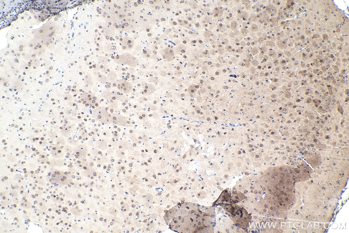 Immunohistochemistry (IHC) staining of rat brain tissue using HIPK2 Polyclonal antibody (55408-1-AP)