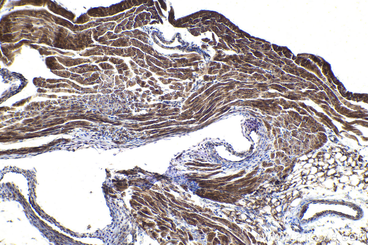 Immunohistochemistry (IHC) staining of mouse heart tissue using HIPK2 Polyclonal antibody (55408-1-AP)