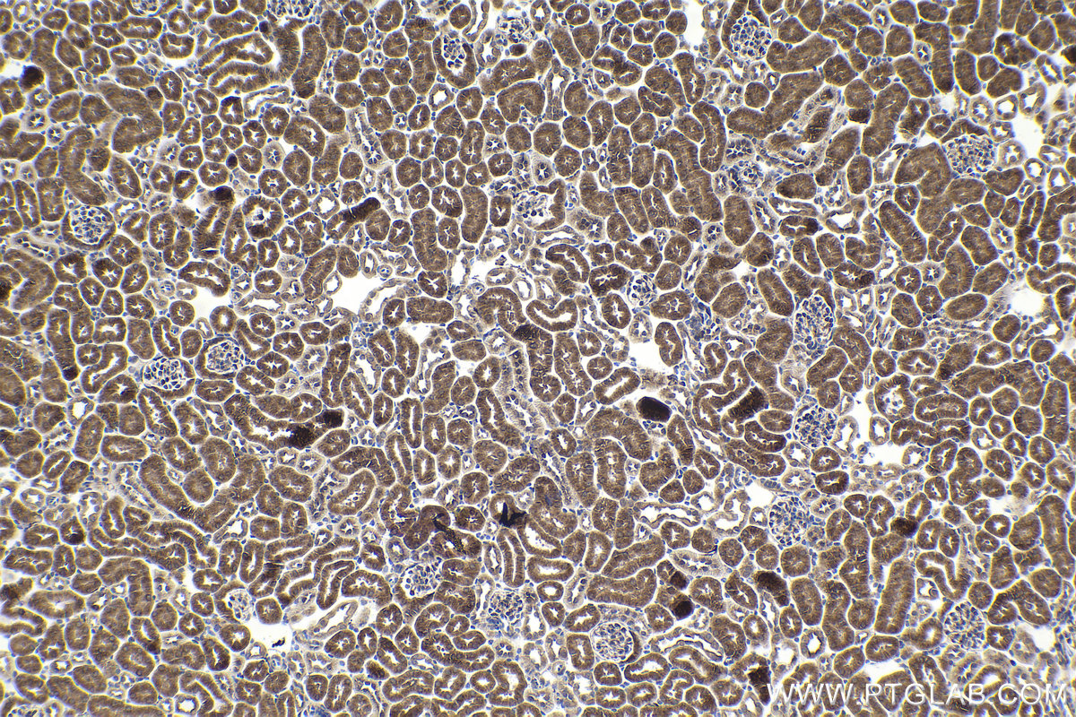 Immunohistochemistry (IHC) staining of mouse kidney tissue using HIPK2 Polyclonal antibody (55408-1-AP)