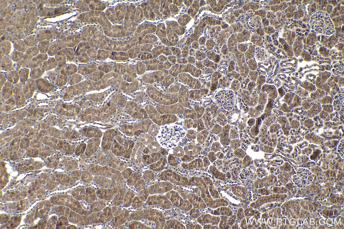 Immunohistochemistry (IHC) staining of rat kidney tissue using HIPK2 Polyclonal antibody (55408-1-AP)