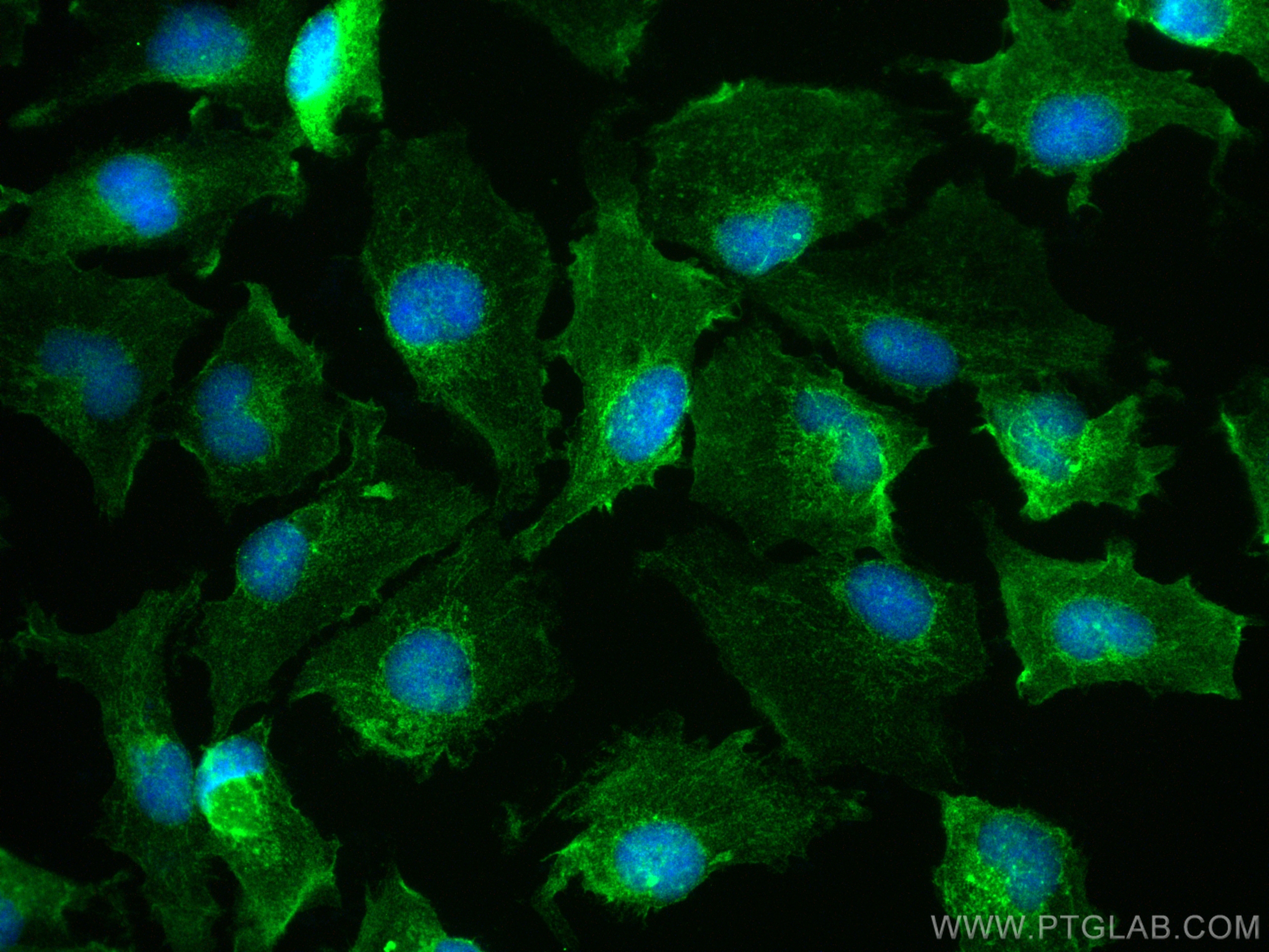 Immunofluorescence (IF) / fluorescent staining of U-251 cells using PPIP5K1 Polyclonal antibody (14331-1-AP)