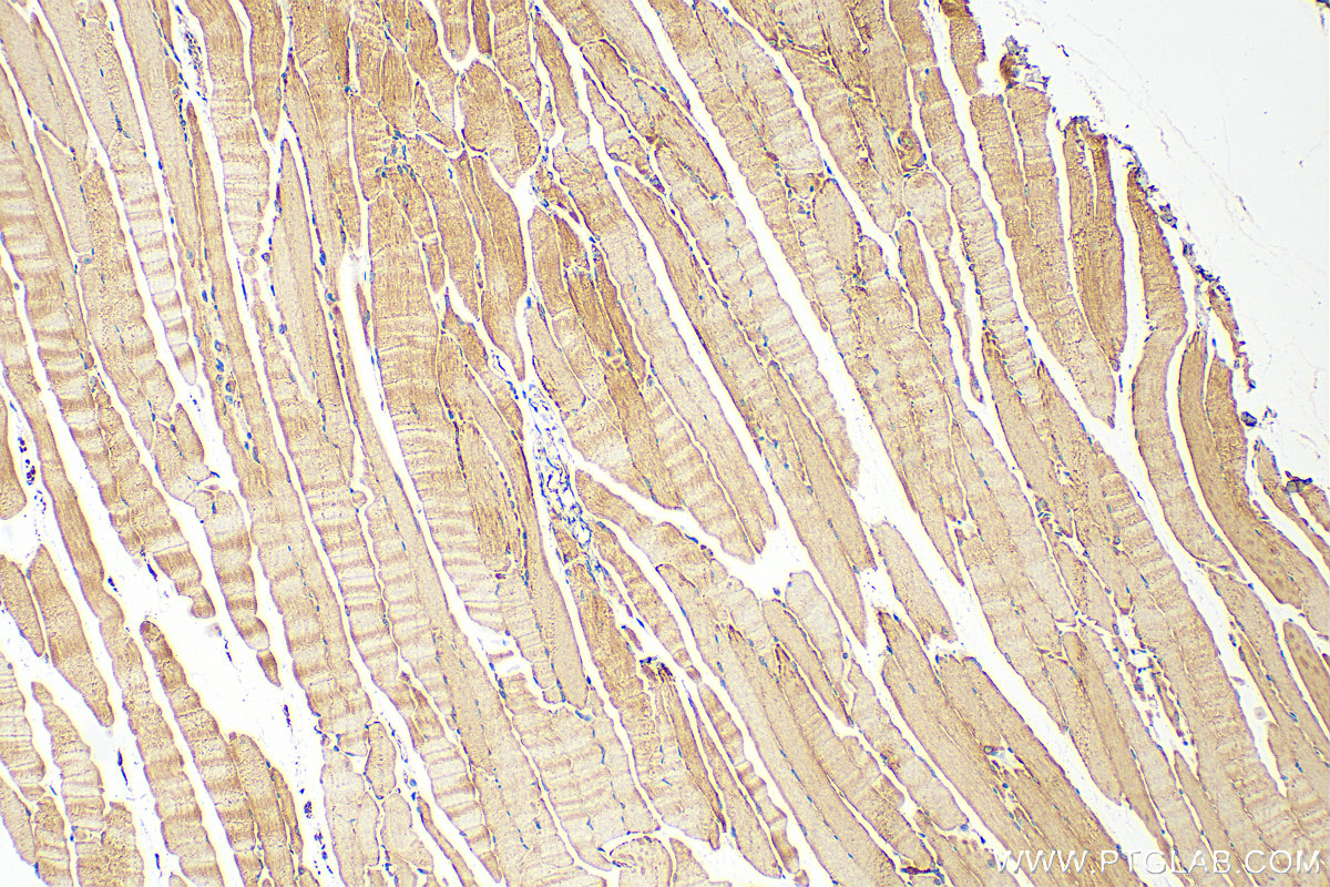 Immunohistochemistry (IHC) staining of mouse skeletal muscle tissue using PPIP5K1 Polyclonal antibody (14331-1-AP)