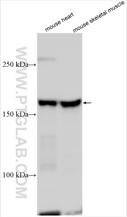 Western Blot (WB) analysis of various lysates using PPIP5K1 Polyclonal antibody (14331-1-AP)