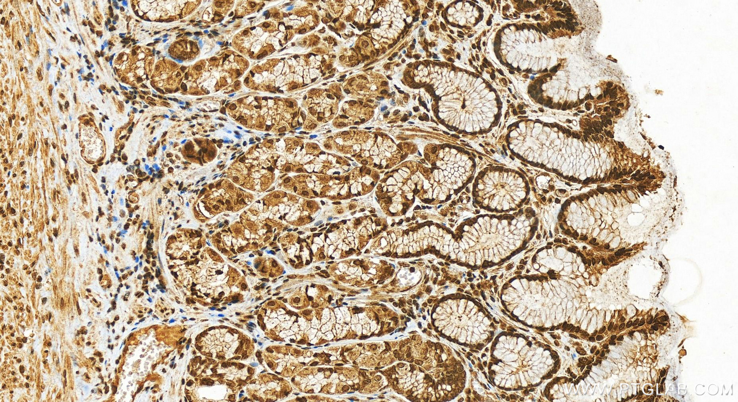 Immunohistochemistry (IHC) staining of human stomach tissue using Histone H1 Polyclonal antibody (18201-1-AP)