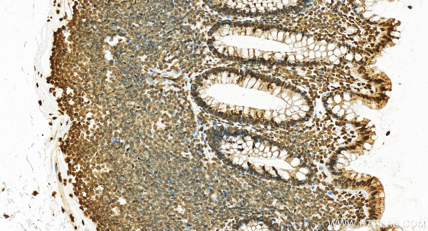 Immunohistochemistry (IHC) staining of human normal colon using Histone H1.2 Polyclonal antibody (19649-1-AP)