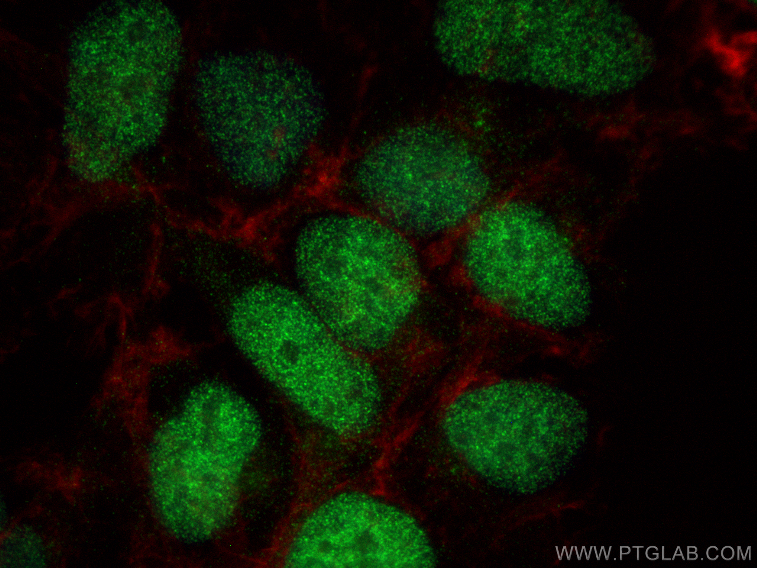 Immunofluorescence (IF) / fluorescent staining of HEK-293 cells using Histone H2B Polyclonal antibody (27740-1-AP)