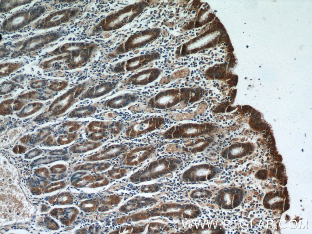 Immunohistochemistry (IHC) staining of human stomach tissue using HIVEP1 Polyclonal antibody (25168-1-AP)