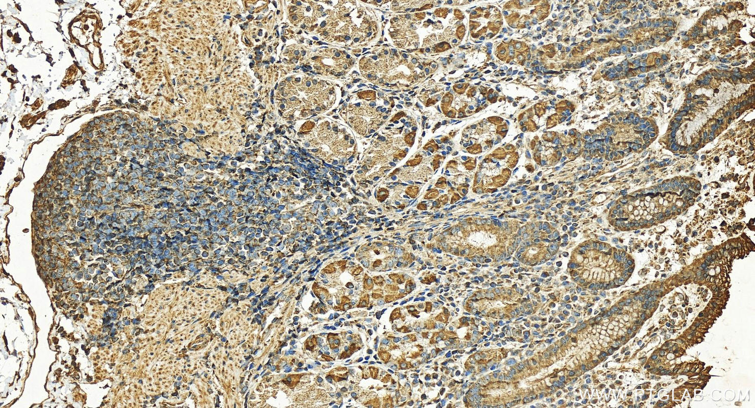 Immunohistochemistry (IHC) staining of human stomach tissue using Hexokinase 1 Polyclonal antibody (15656-1-AP)