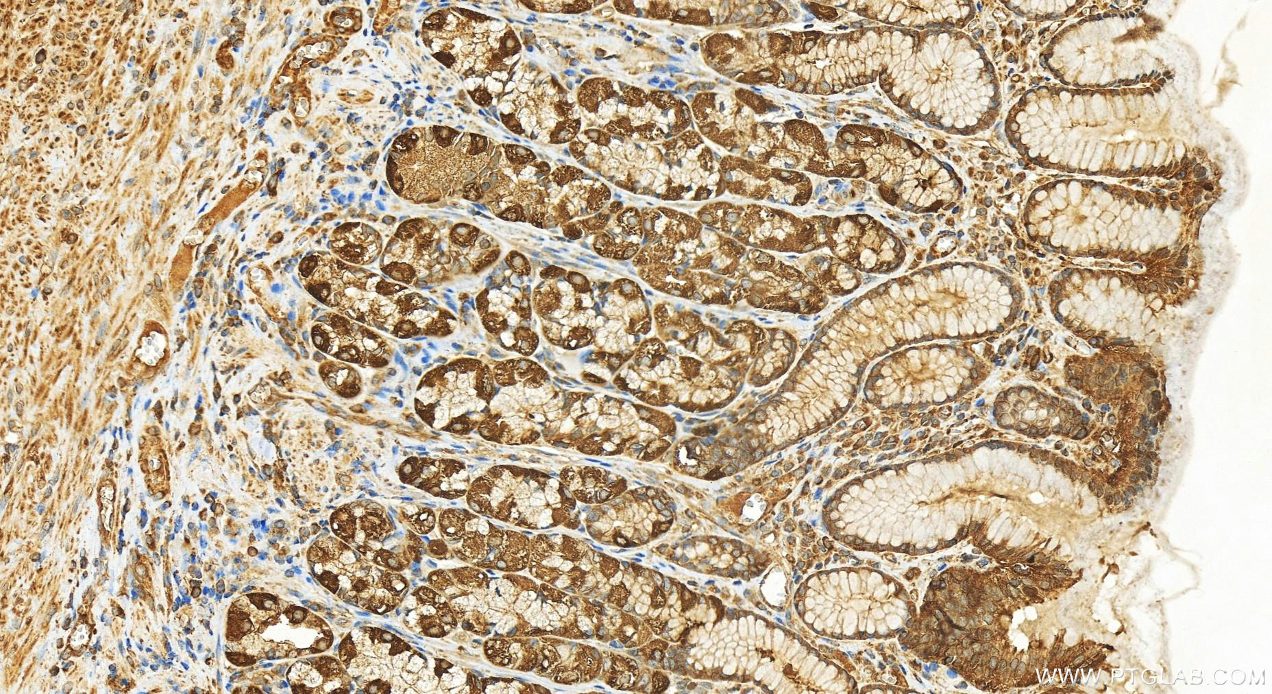 Immunohistochemistry (IHC) staining of human stomach tissue using Hexokinase 1 Polyclonal antibody (19662-1-AP)