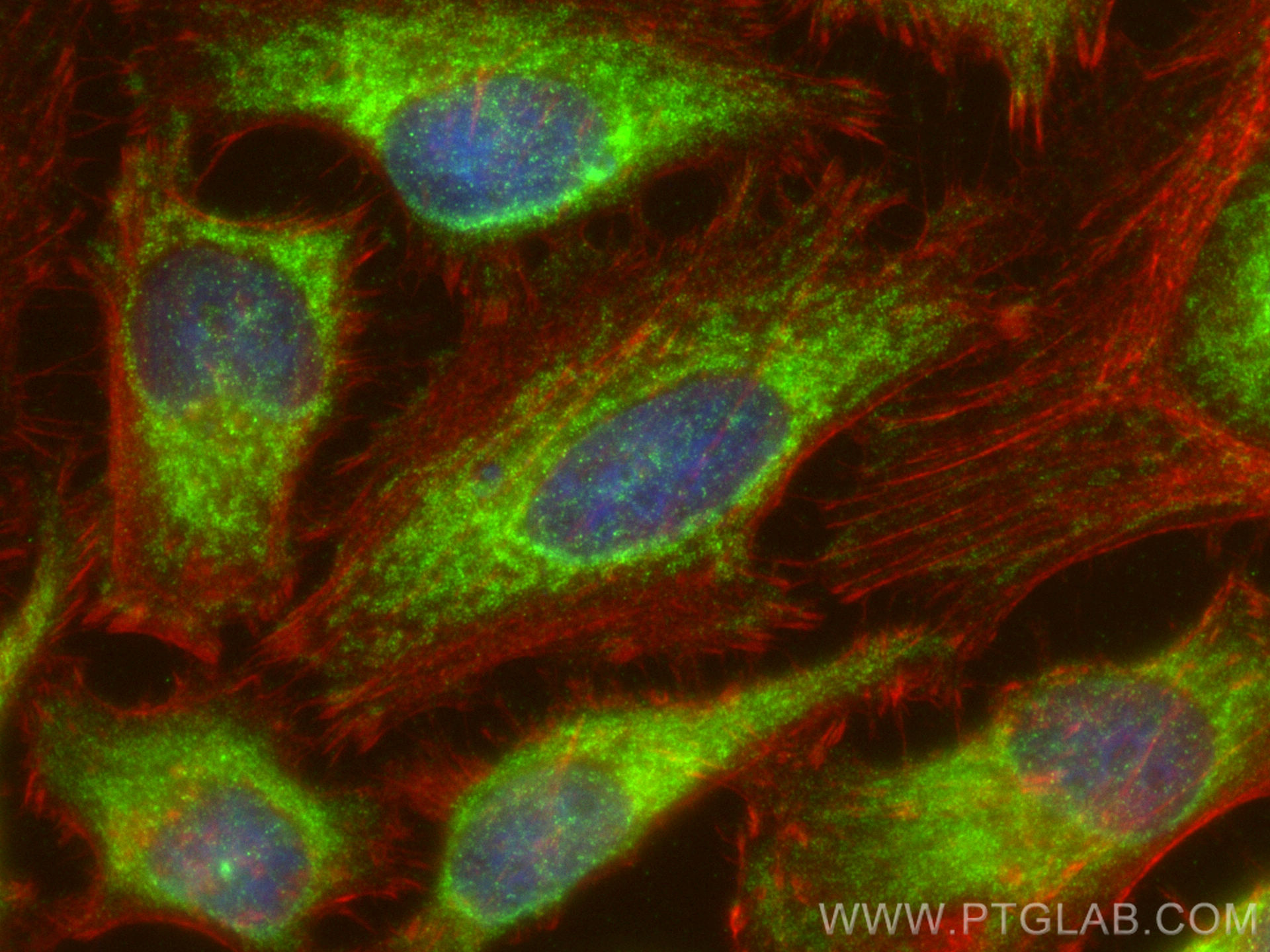 Immunofluorescence (IF) / fluorescent staining of HeLa cells using Hexokinase 1 Polyclonal antibody (19662-1-AP)