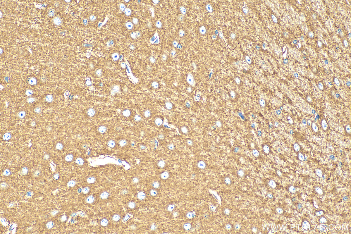 Immunohistochemistry (IHC) staining of mouse brain tissue using Hexokinase 1 Polyclonal antibody (19662-1-AP)