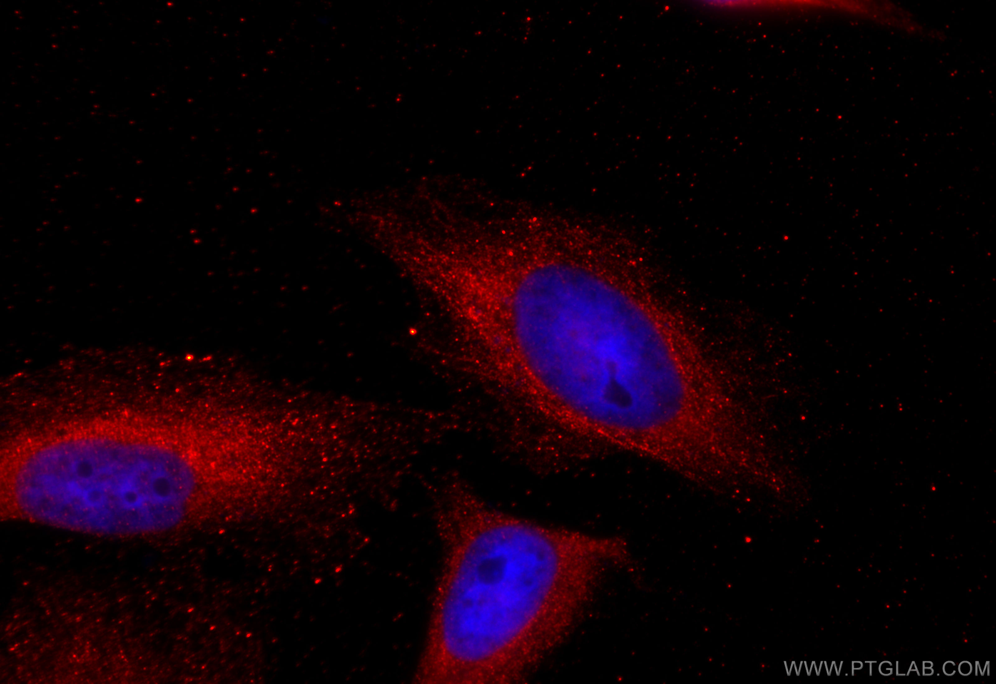 Immunofluorescence (IF) / fluorescent staining of HeLa cells using Hexokinase 2 Polyclonal antibody (22029-1-AP)