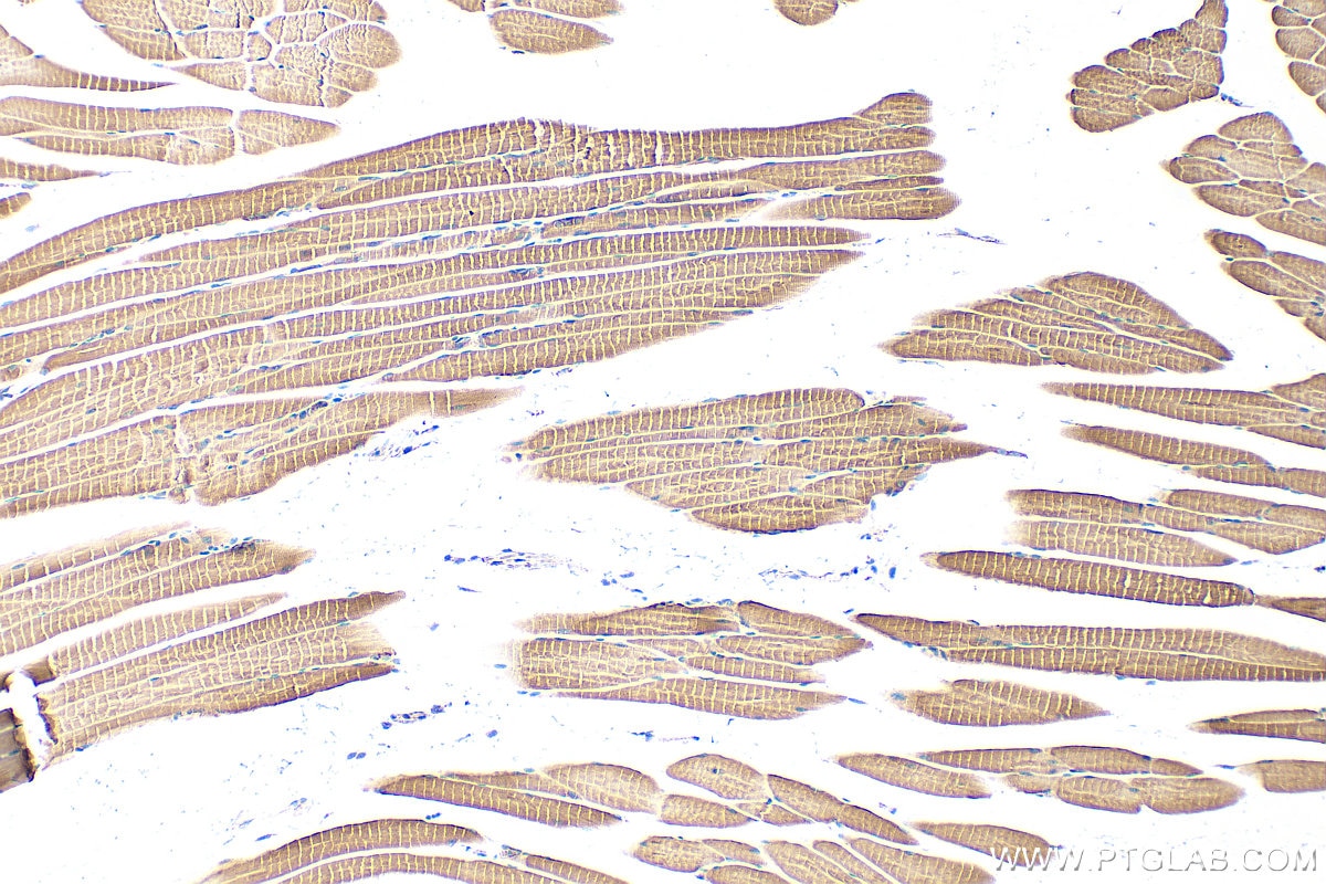 Immunohistochemistry (IHC) staining of mouse skeletal muscle tissue using Hexokinase 2 Polyclonal antibody (22029-1-AP)