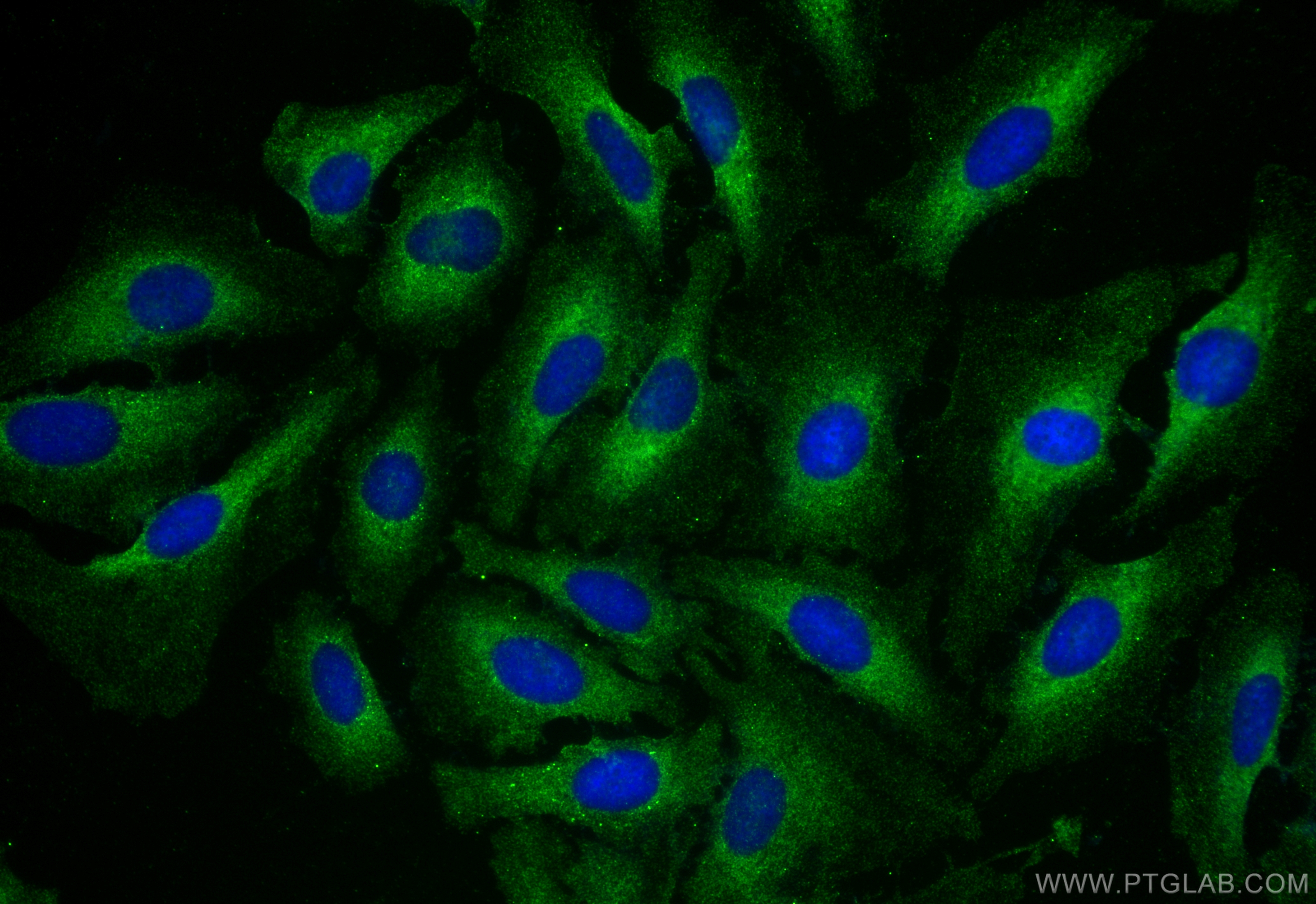 Immunofluorescence (IF) / fluorescent staining of HeLa cells using Hexokinase 2 Monoclonal antibody (66974-1-Ig)