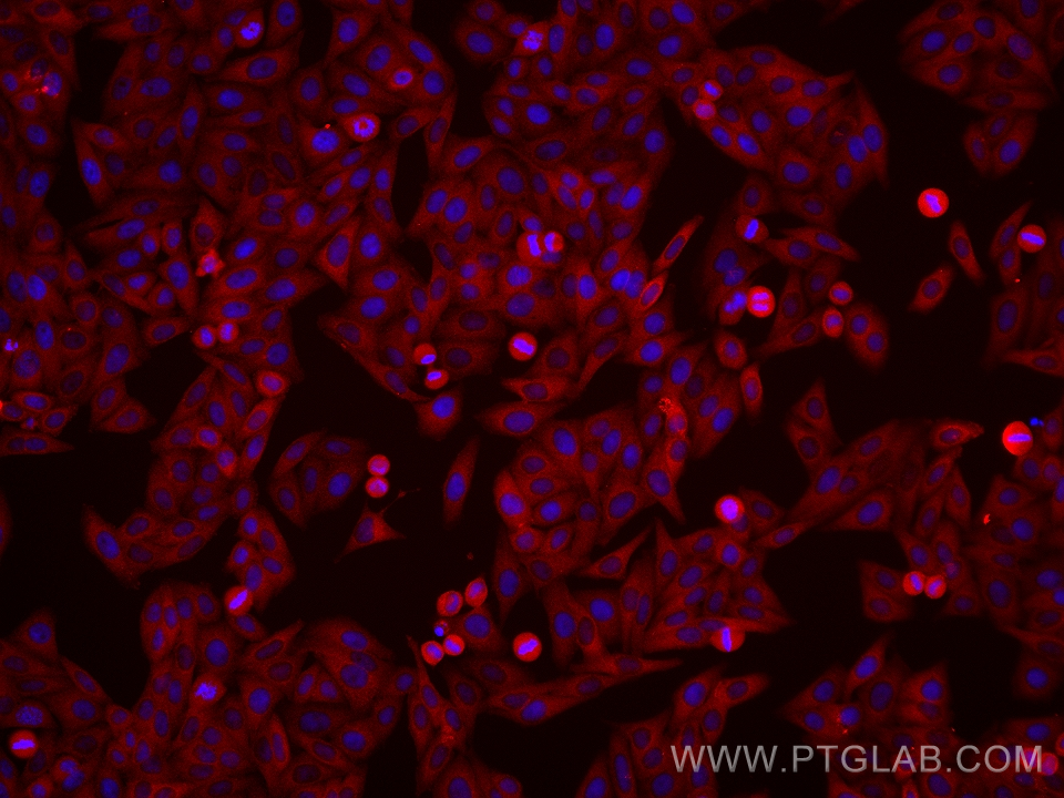 Immunofluorescence (IF) / fluorescent staining of HepG2 cells using Hexokinase 2 Monoclonal antibody (66974-1-Ig)