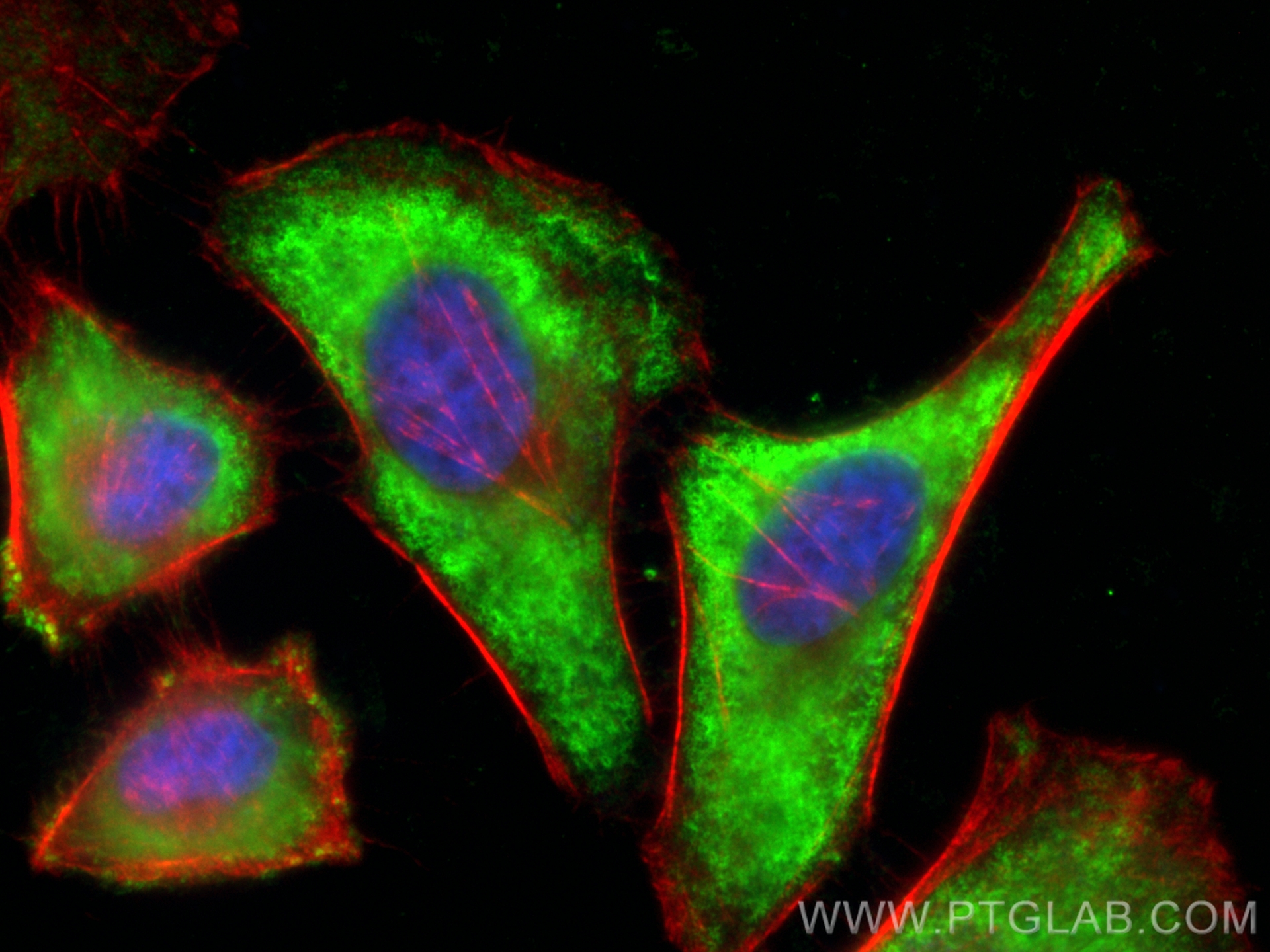 Immunofluorescence (IF) / fluorescent staining of HeLa cells using CoraLite® Plus 488-conjugated HK3 Monoclonal antib (CL488-67803)