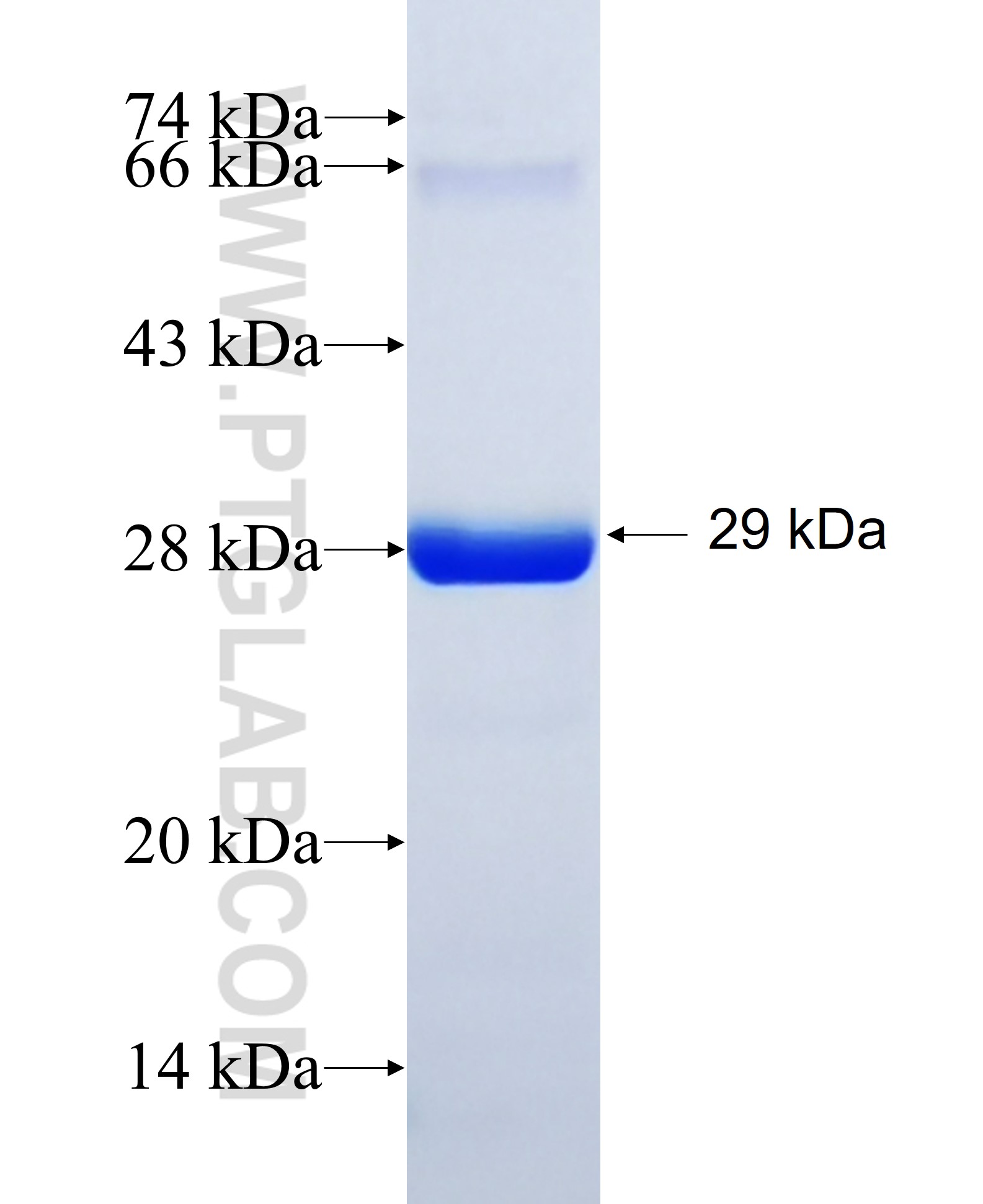 HKDC1 fusion protein Ag34543 SDS-PAGE