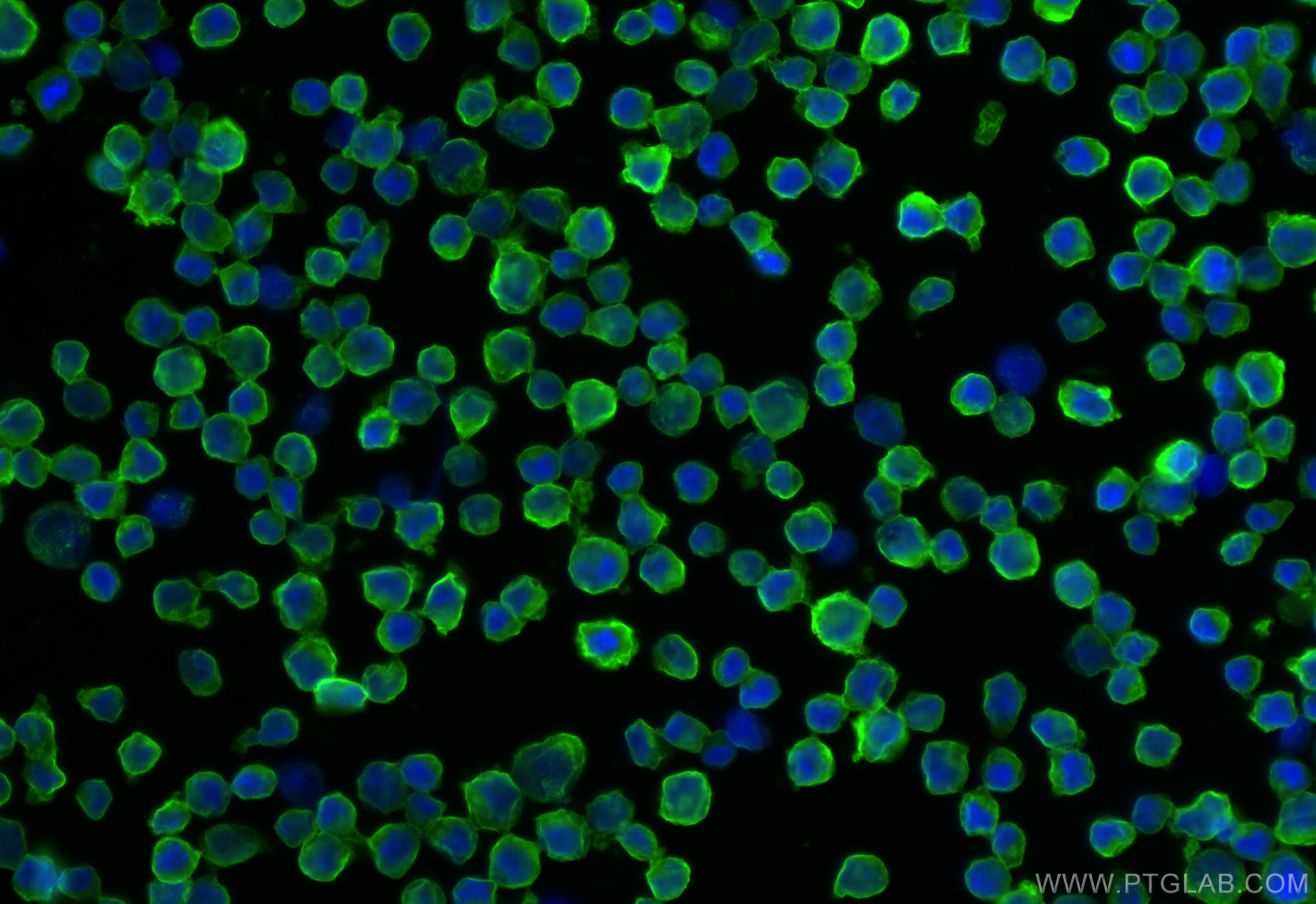 Immunofluorescence (IF) / fluorescent staining of Raji cells using HLA class I ABC Polyclonal antibody (15240-1-AP)