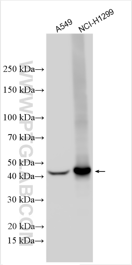 Western Blot (WB) analysis of various lysates using HLA class I ABC Polyclonal antibody (15240-1-AP)