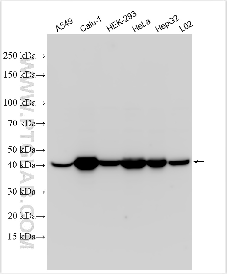 Western Blot (WB) analysis of various lysates using HLA class I ABC Polyclonal antibody (15240-1-AP)