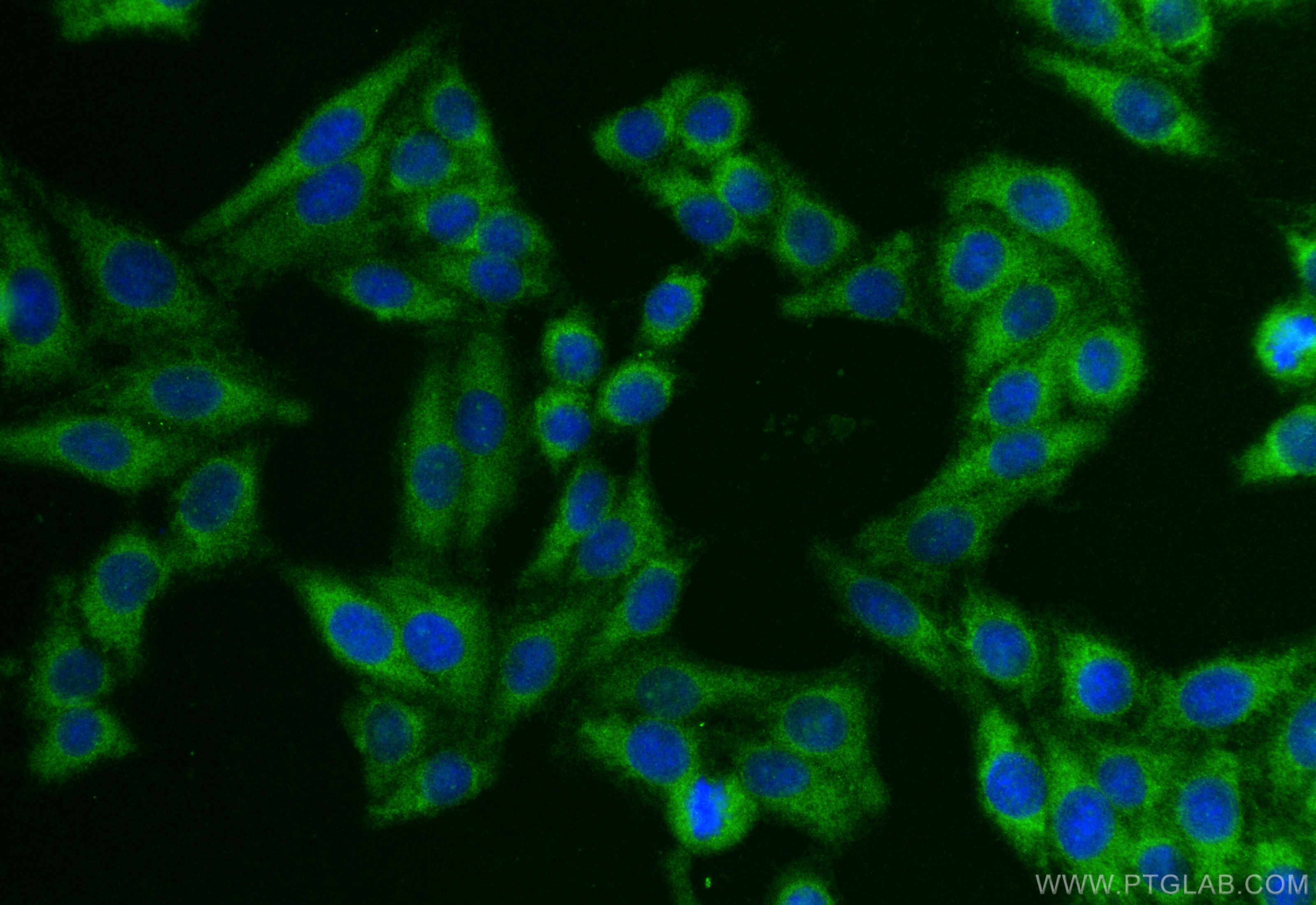 Immunofluorescence (IF) / fluorescent staining of HepG2 cells using HLA-A Polyclonal antibody (55383-1-AP)