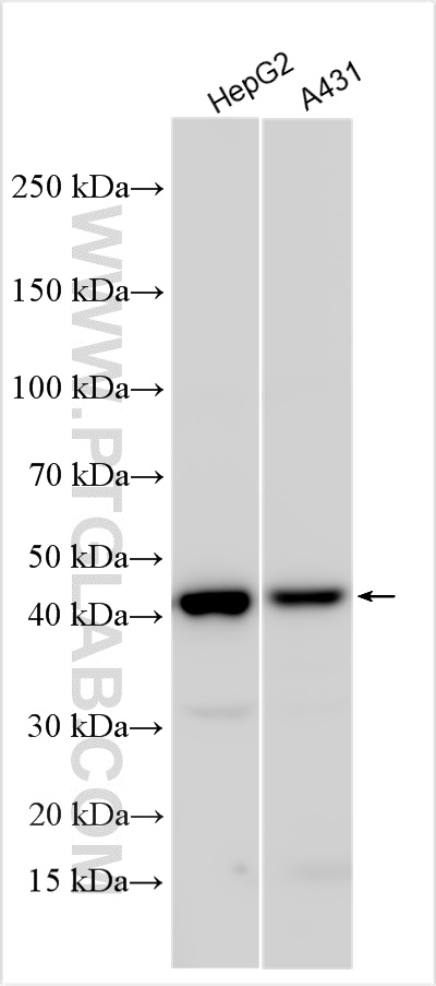 Western Blot (WB) analysis of various lysates using HLA-A Polyclonal antibody (55383-1-AP)