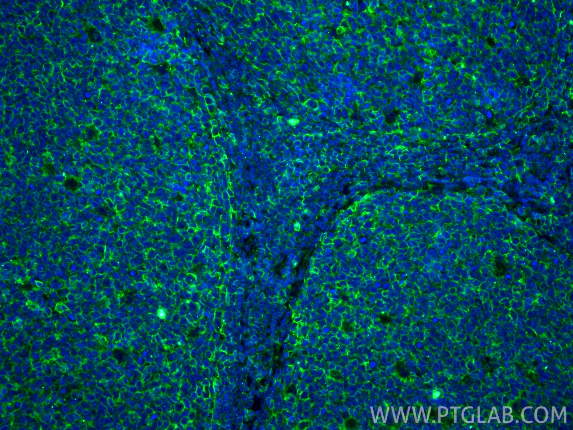 Immunofluorescence (IF) / fluorescent staining of human tonsillitis tissue using HLA class I ABC Monoclonal antibody (66013-1-Ig)