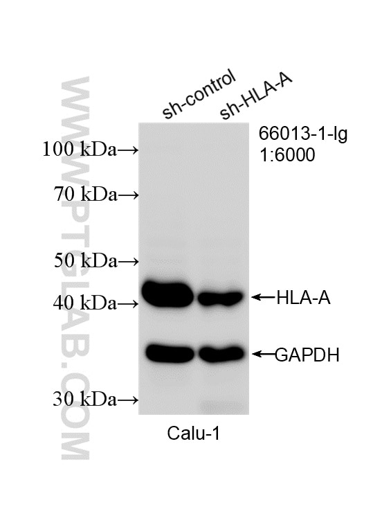 Western Blot (WB) analysis of Calu-1 cells using HLA class I ABC Monoclonal antibody (66013-1-Ig)