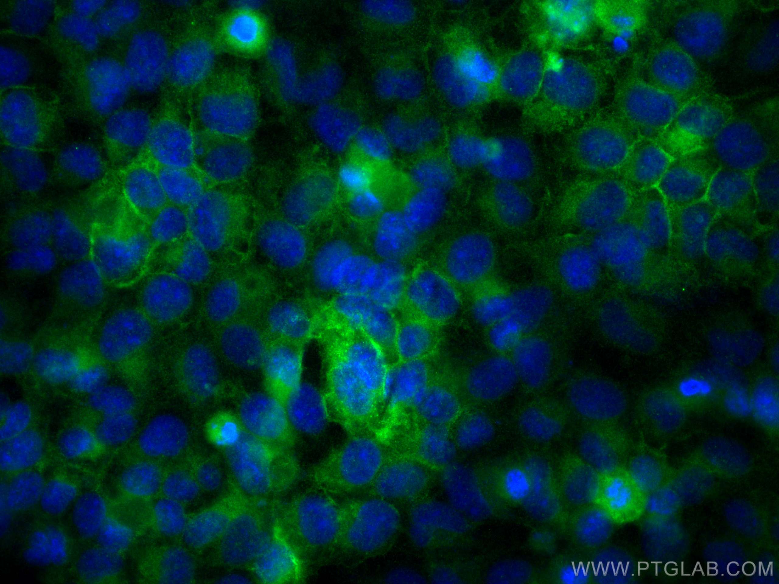 Immunofluorescence (IF) / fluorescent staining of HeLa cells using HLA class I (HLA-C) Polyclonal antibody (15777-1-AP)