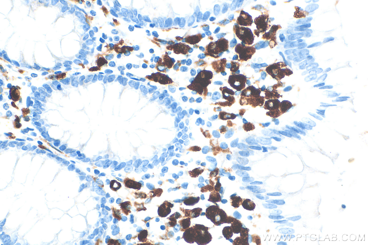 Immunohistochemistry (IHC) staining of human colon tissue using HLA-DMA Recombinant antibody (82899-2-RR)