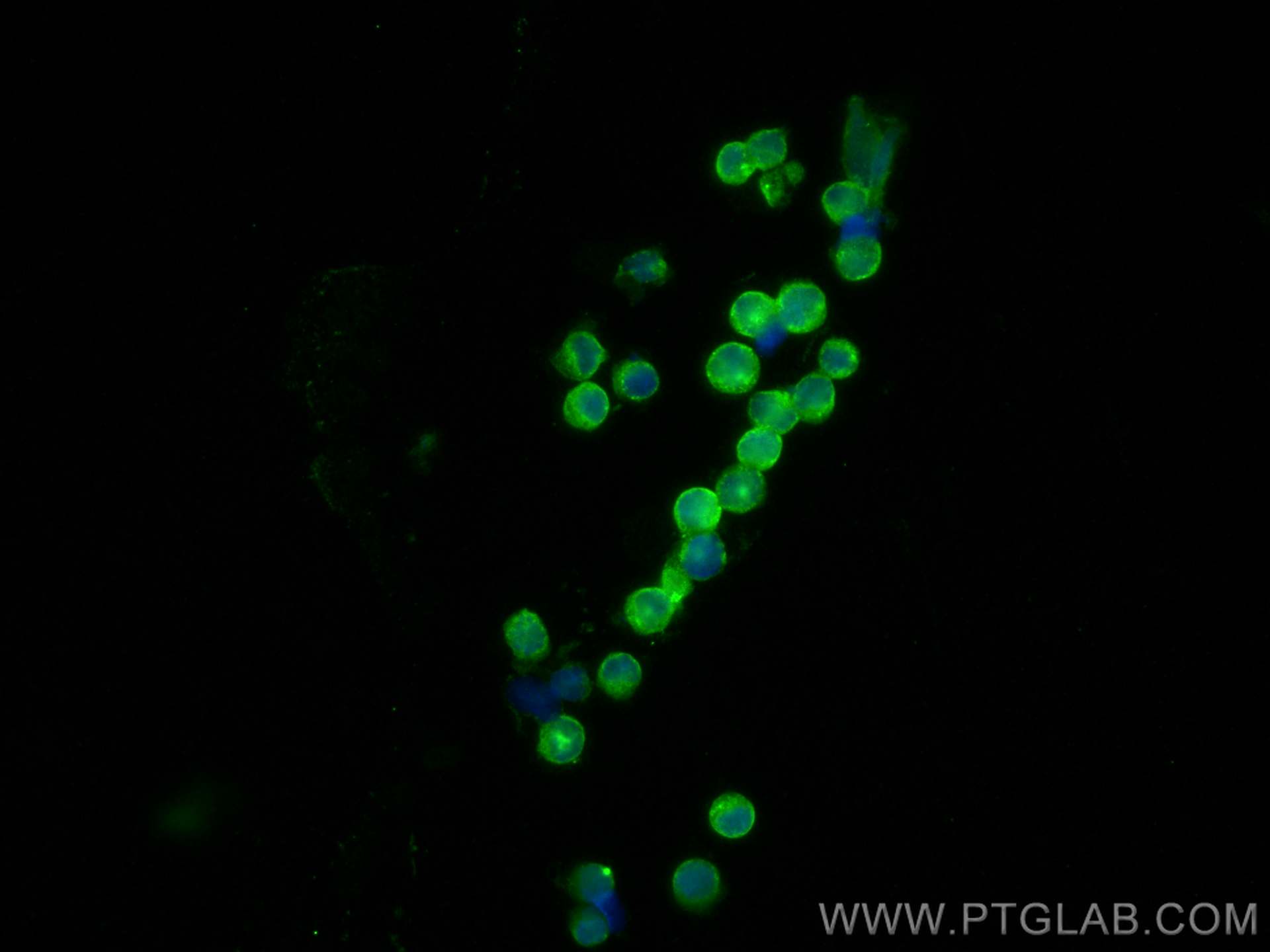 Immunofluorescence (IF) / fluorescent staining of Raji cells using HLA-DMB Polyclonal antibody (21704-1-AP)