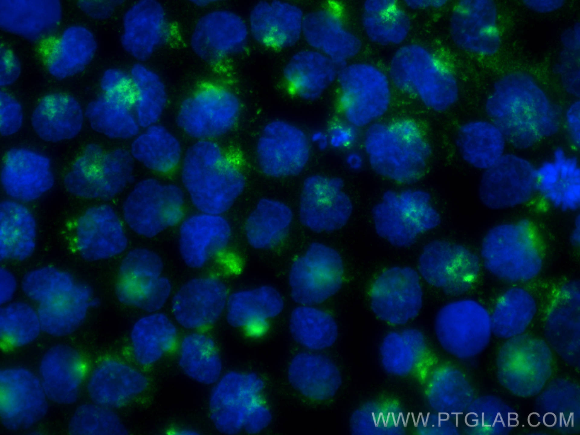 Immunofluorescence (IF) / fluorescent staining of Raji cells using HLA-DMB Recombinant antibody (82922-1-RR)