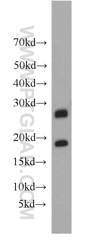 Western Blot (WB) analysis of mouse thymus tissue using HLA-DQA2 Polyclonal antibody (55072-1-AP)