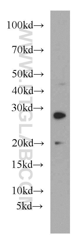 Western Blot (WB) analysis of mouse spleen tissue using HLA-DQA2 Polyclonal antibody (55072-1-AP)