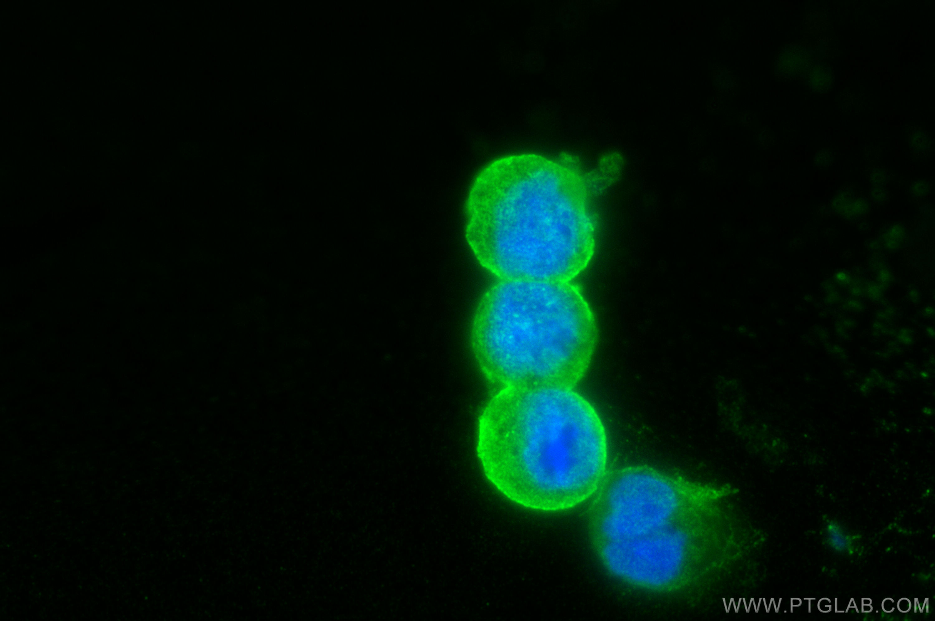 Immunofluorescence (IF) / fluorescent staining of Raji cells using HLA-DRA Polyclonal antibody (17221-1-AP)