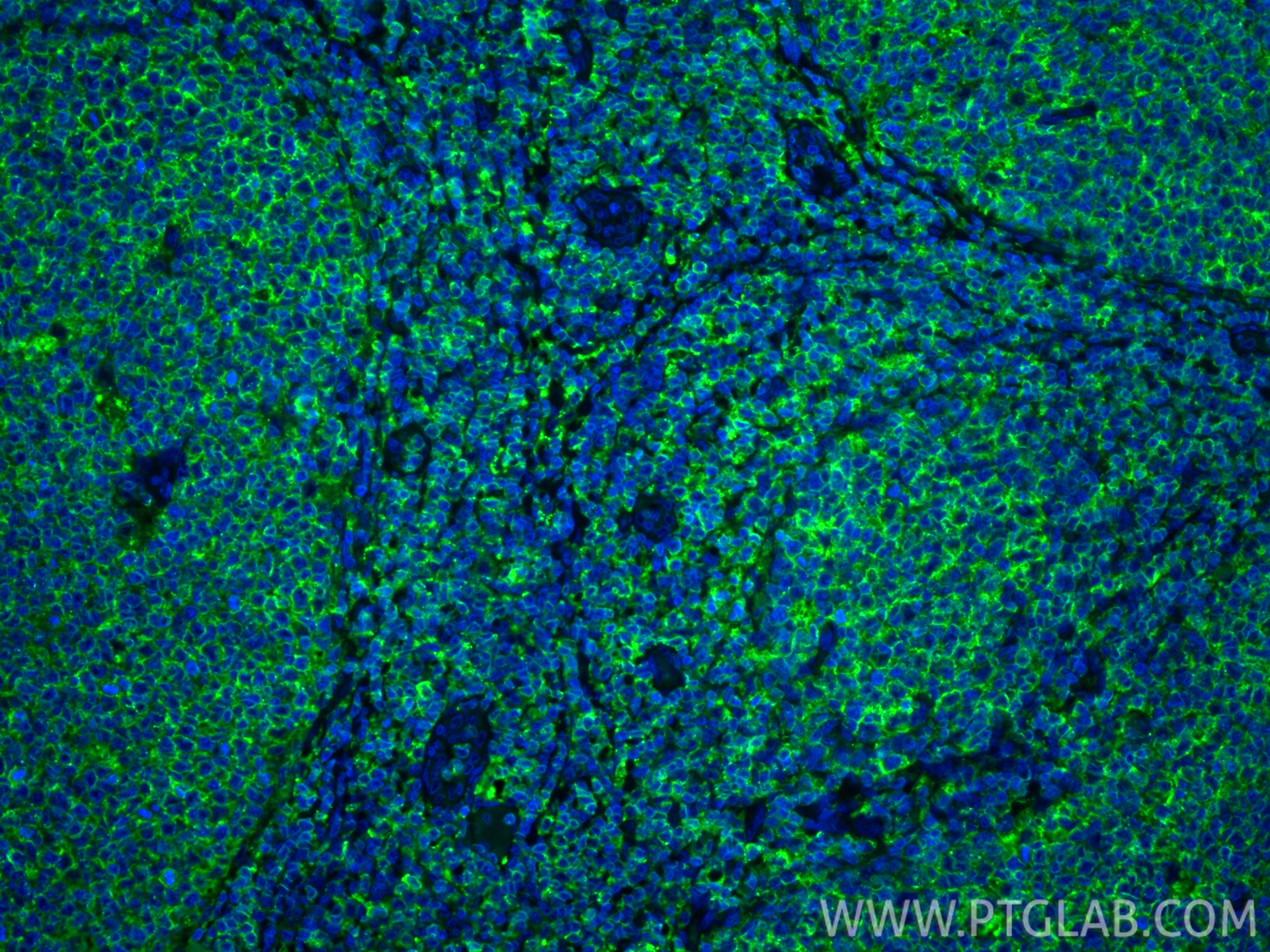 Immunofluorescence (IF) / fluorescent staining of human tonsillitis tissue using HLA-DRA Polyclonal antibody (17221-1-AP)