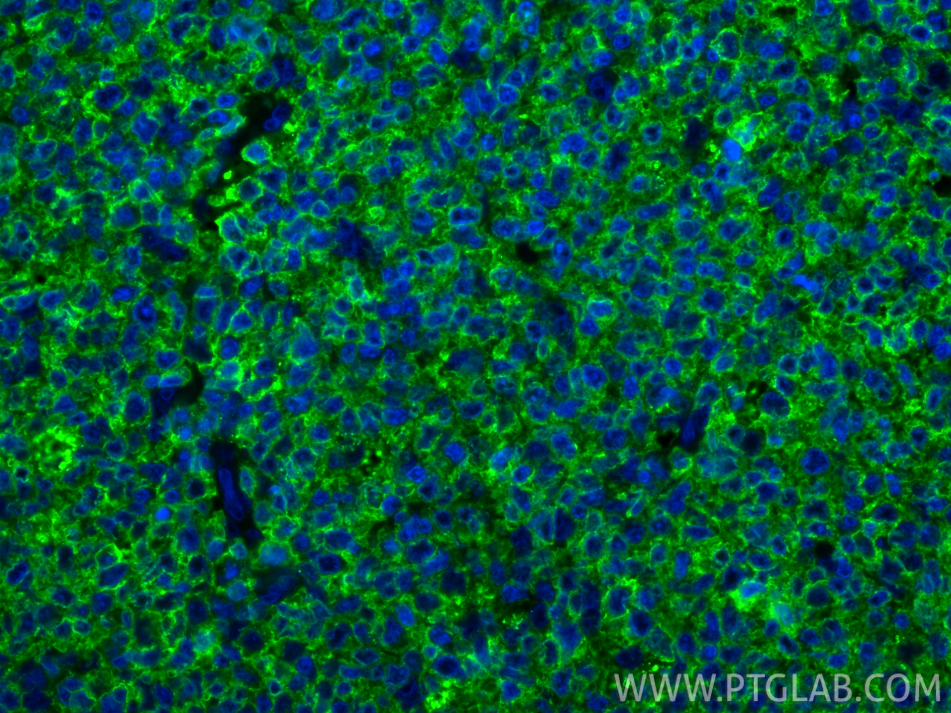Immunofluorescence (IF) / fluorescent staining of human tonsillitis tissue using HLA-DRA Polyclonal antibody (17221-1-AP)