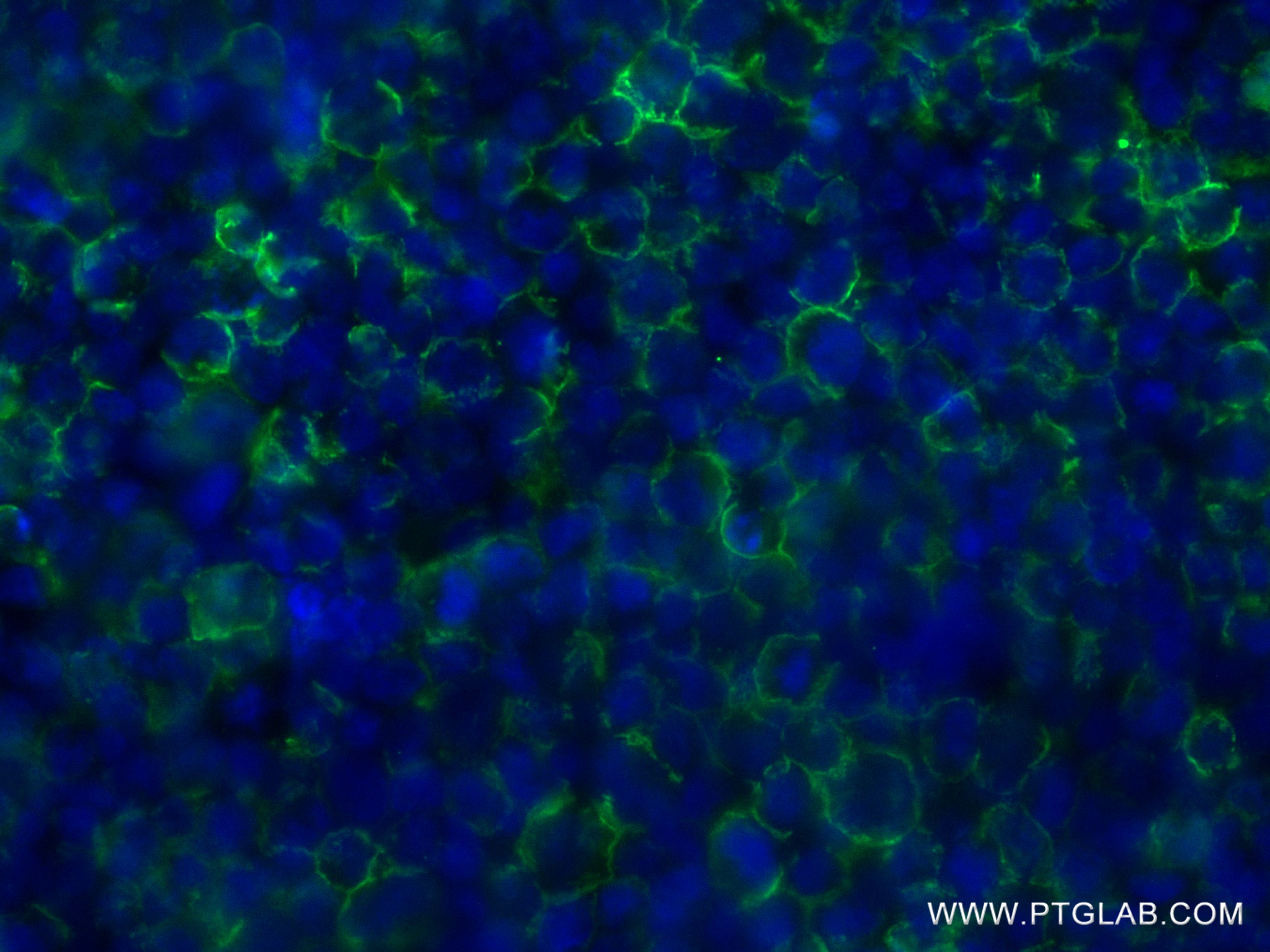 Immunofluorescence (IF) / fluorescent staining of Raji cells using HLA-DRB4 Recombinant antibody (83103-1-RR)