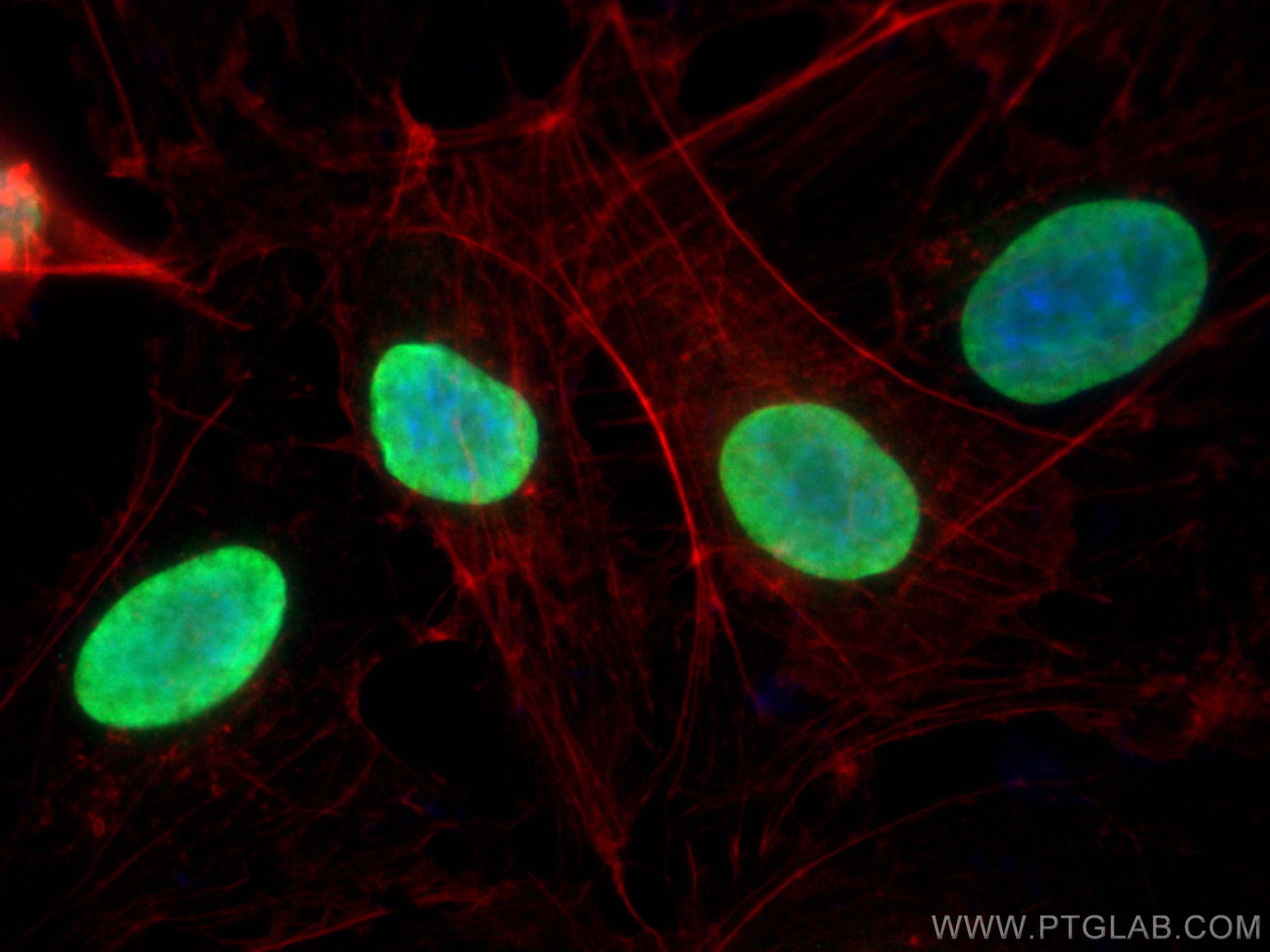 Immunofluorescence (IF) / fluorescent staining of HUVEC cells using HMGA1 Polyclonal antibody (29895-1-AP)