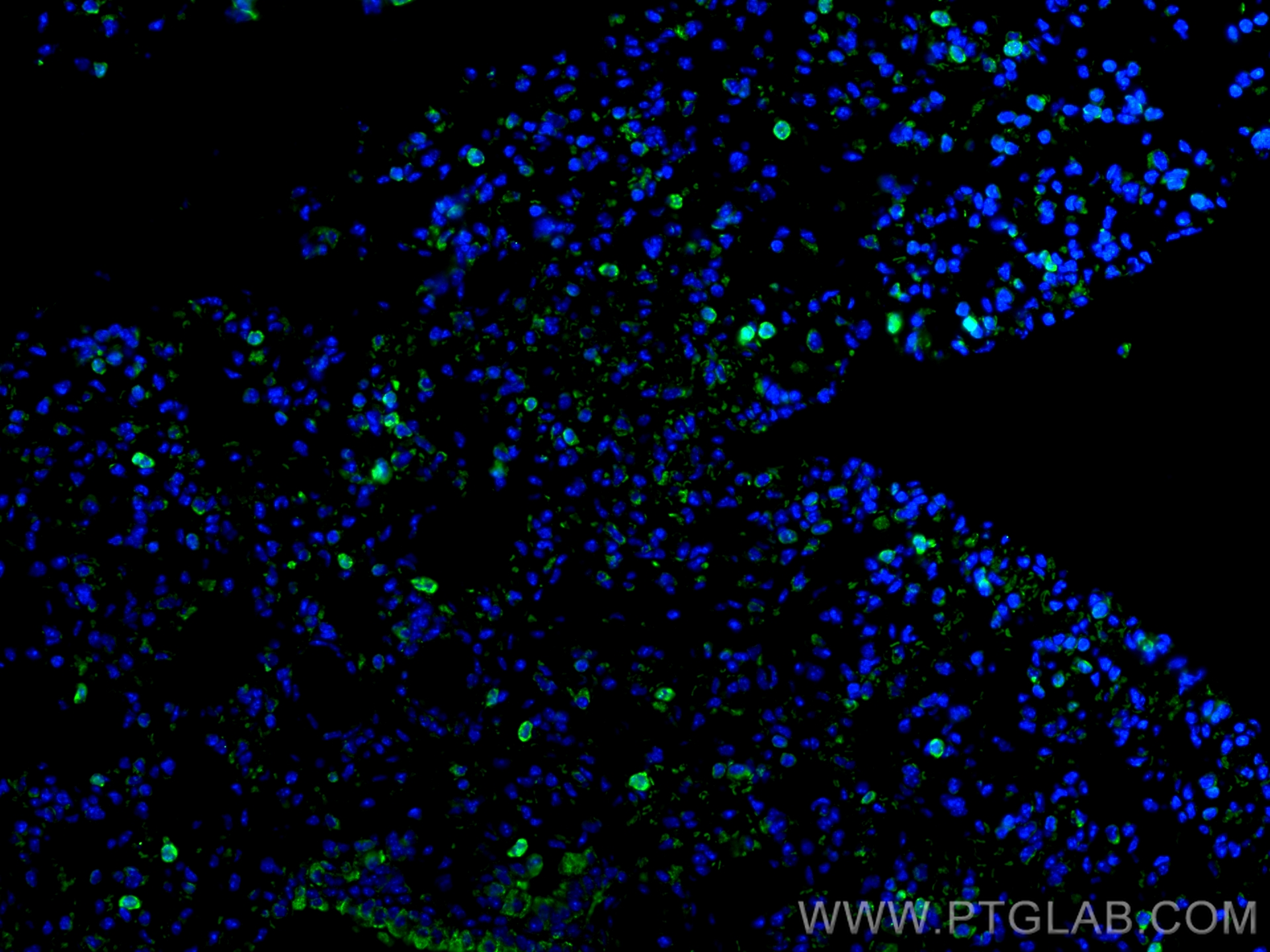 Immunofluorescence (IF) / fluorescent staining of mouse lung tissue using HMGB1 Monoclonal antibody (66525-1-Ig)