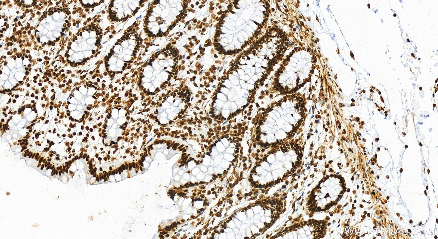 Immunohistochemistry (IHC) staining of human normal colon using HMGB1 Recombinant antibody (82973-1-RR)