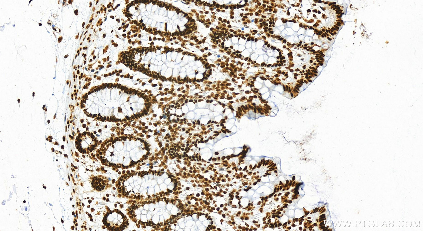 Immunohistochemistry (IHC) staining of human normal colon using HMGB1 Recombinant antibody (82973-1-RR)