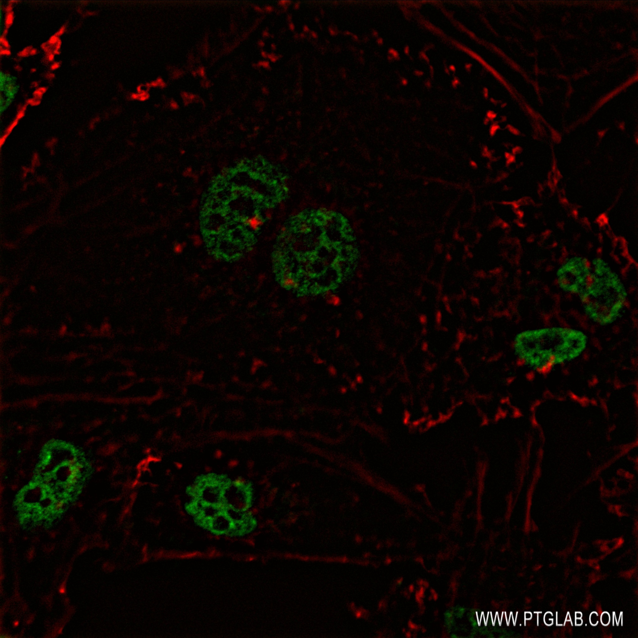 Immunofluorescence (IF) / fluorescent staining of HeLa cells using HMGB1 Recombinant antibody (82973-1-RR)