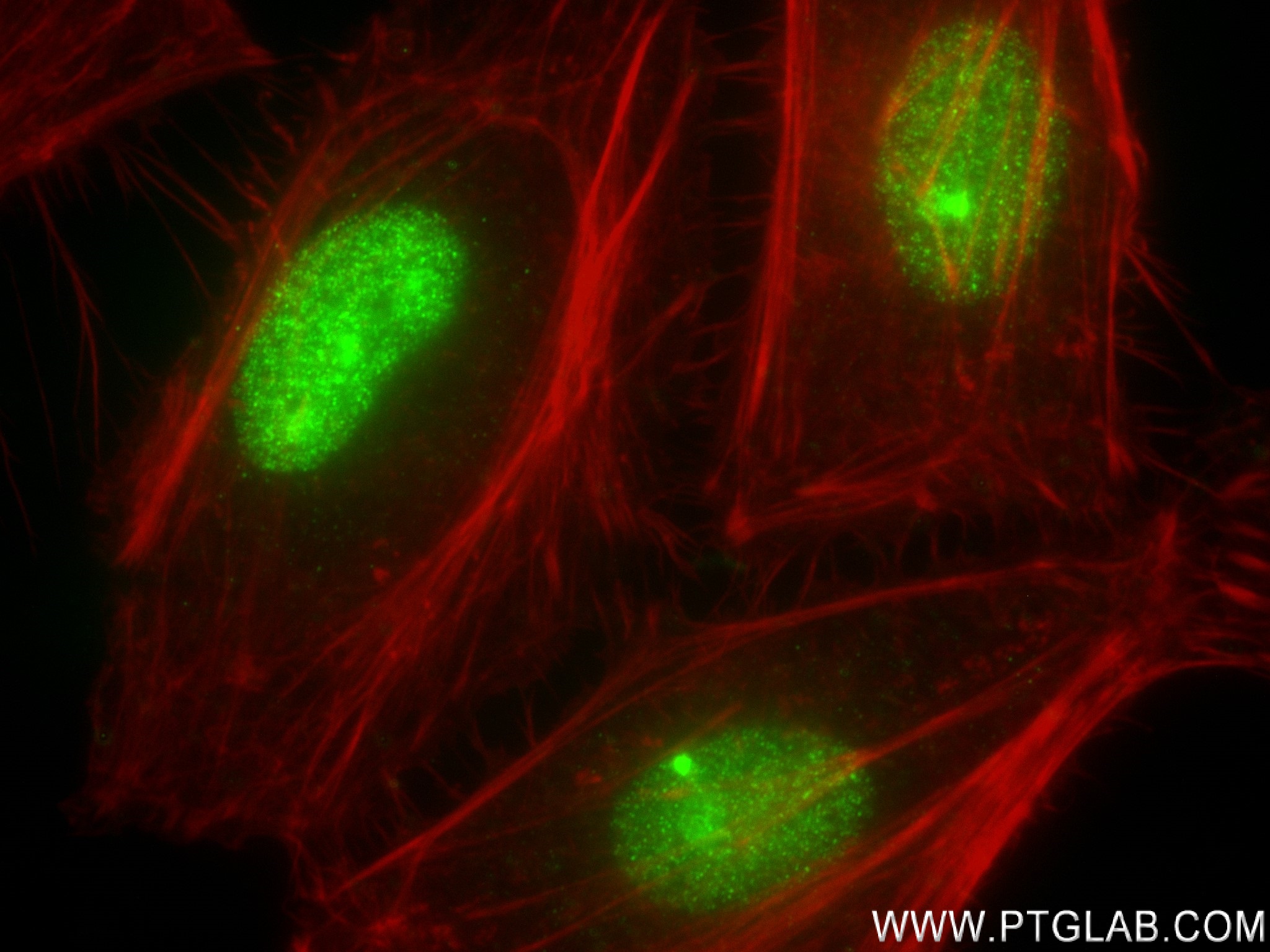 Immunofluorescence (IF) / fluorescent staining of HeLa cells using HMGB1 Recombinant antibody (82973-1-RR)