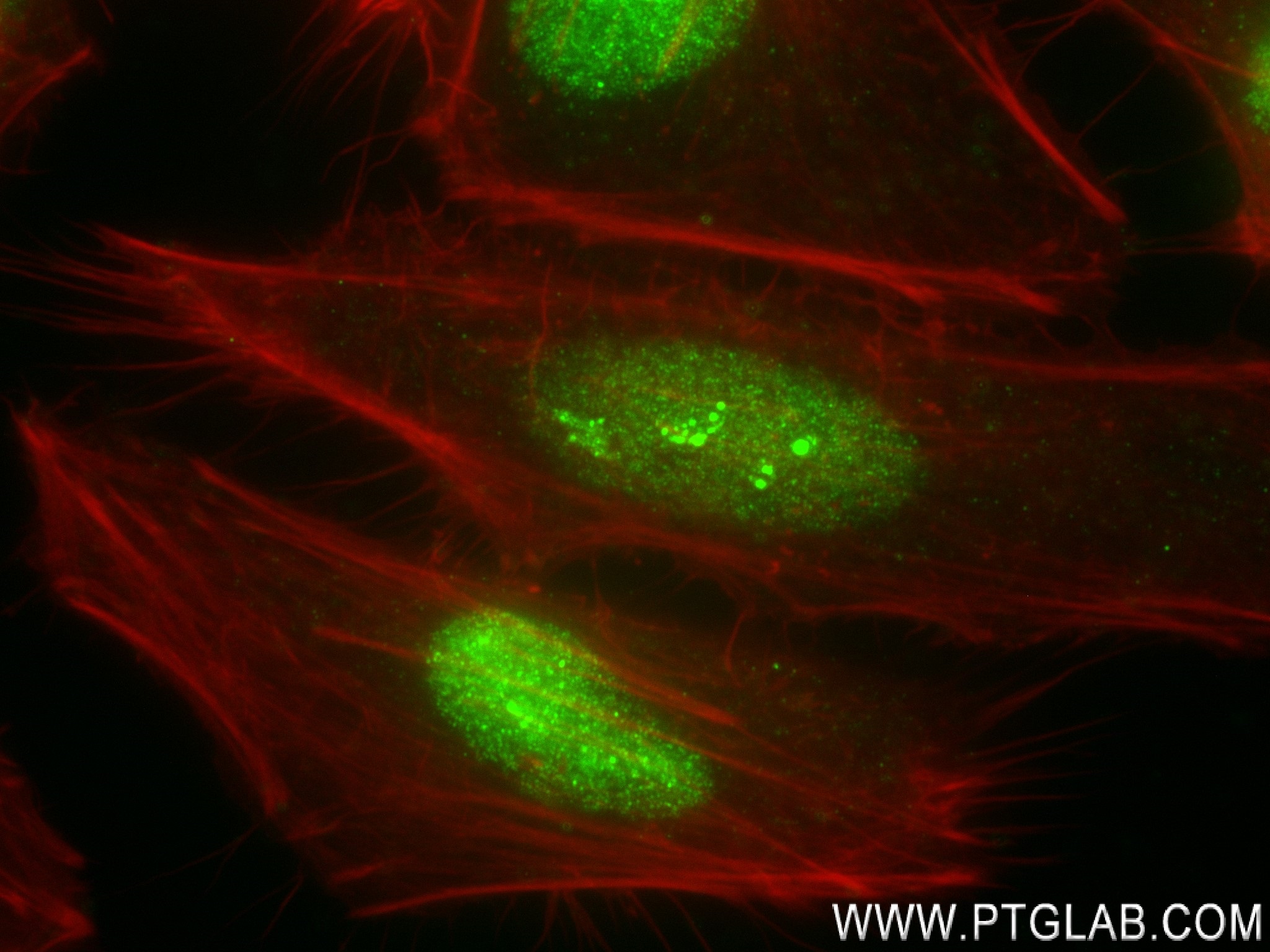 Immunofluorescence (IF) / fluorescent staining of HeLa cells using HMGB1 Recombinant antibody (82973-1-RR)