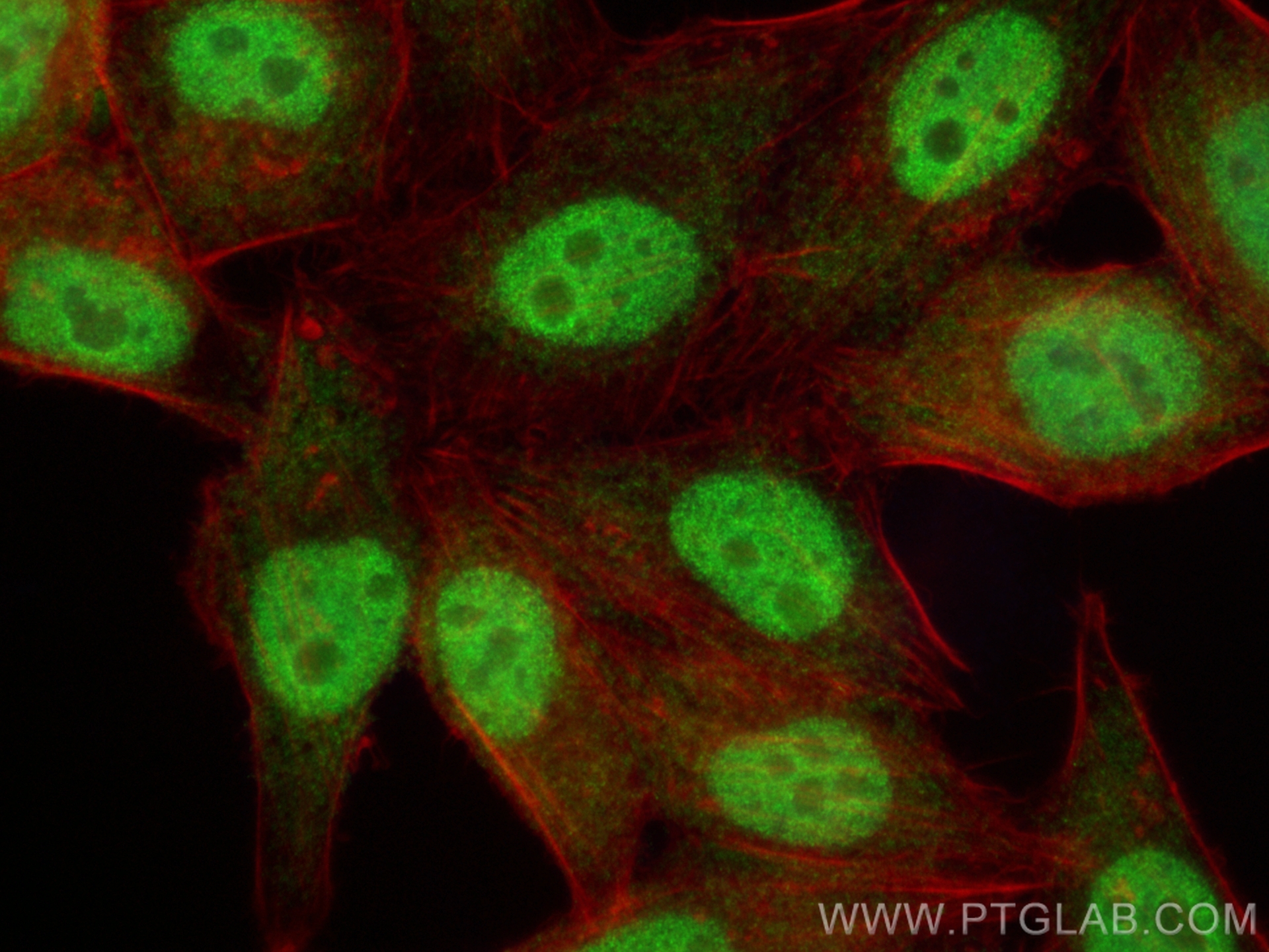 Immunofluorescence (IF) / fluorescent staining of HepG2 cells using HMGB2 Polyclonal antibody (14597-1-AP)