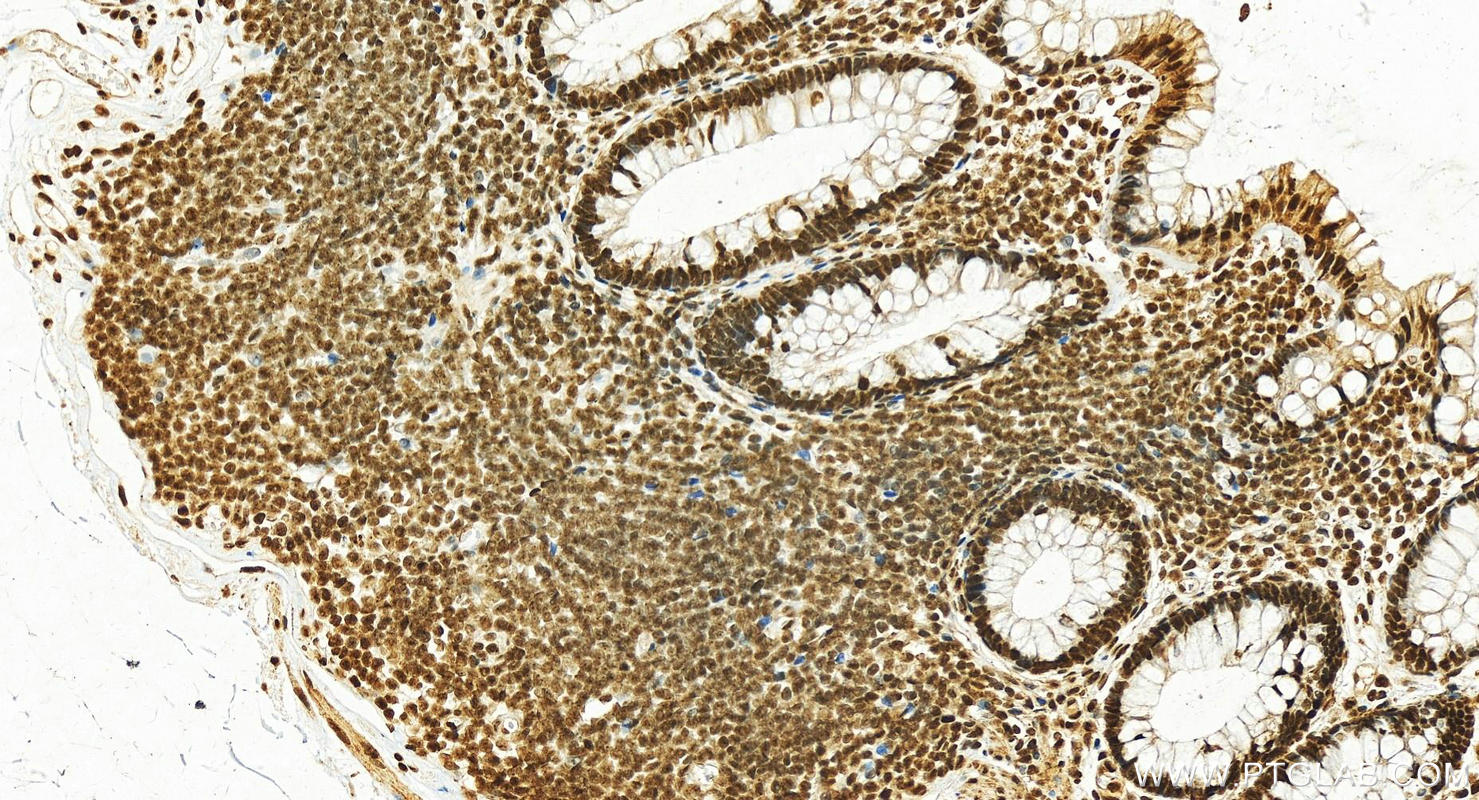 Immunohistochemistry (IHC) staining of human normal colon using HMGB2 Polyclonal antibody (15605-1-AP)