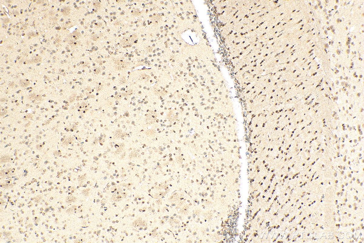 Immunohistochemistry (IHC) staining of mouse brain tissue using HMGB2 Monoclonal antibody (68185-1-Ig)